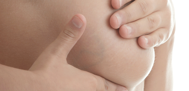 Breast Screening Options