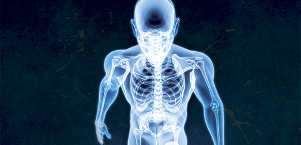 Osteoporosis and Men