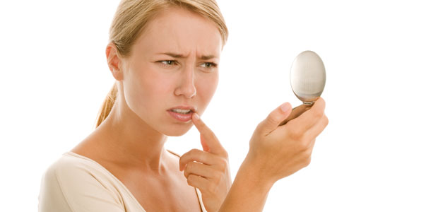 Conquering Cold Sores