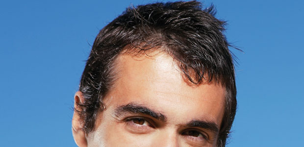 The Roots of Hair Loss