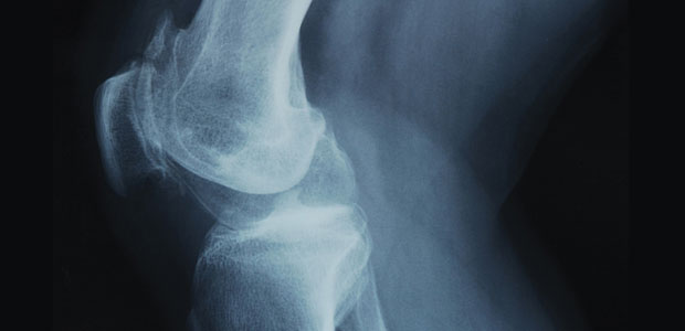 Renew Those Worn Joints