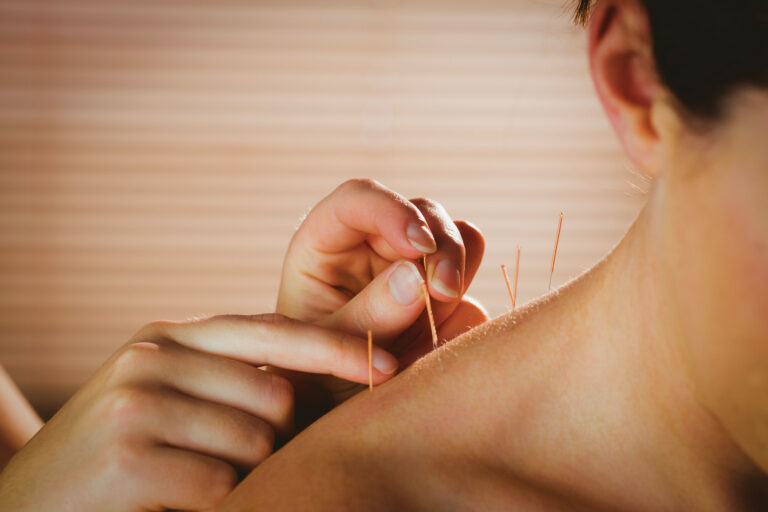 Traditional Chinese Medicine